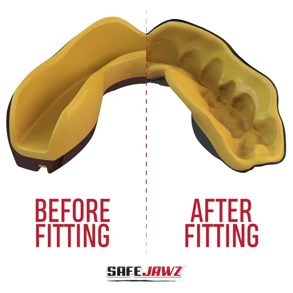 SafeJawz Extro Series Goldie Mouthguard 6 SafeJawz Extro Series Goldie Mouthguard - Image 4