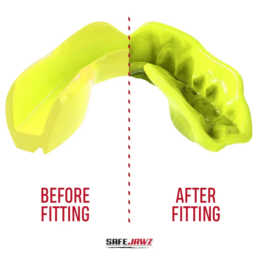 SafeJawz Intro Series Fluro Yellow Mouthguard 5 SafeJawz Intro Series Fluro Yellow Mouthguard - Image 3