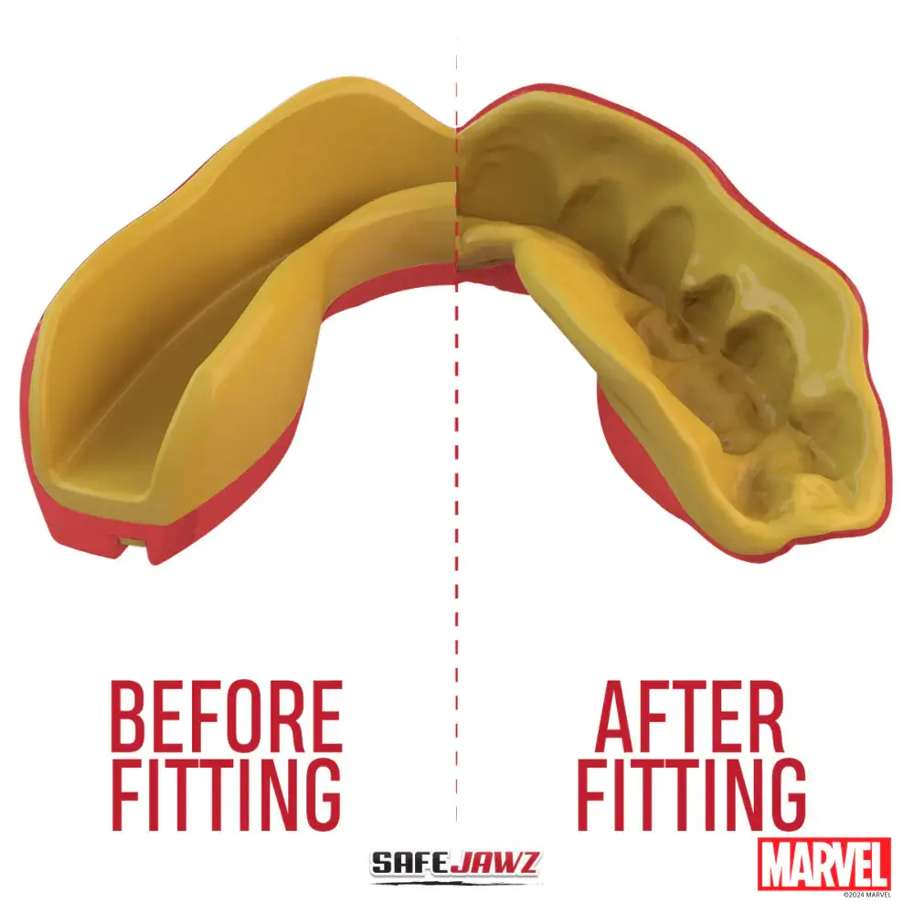 SafeJawz Marvel Iron Man Mouthguard 4 SafeJawz Marvel Iron Man Mouthguard - Image 2